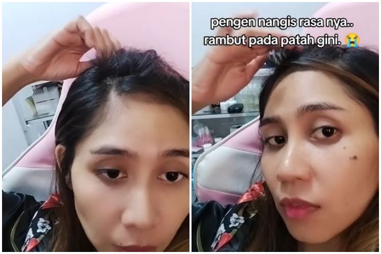 Kulit Mengelupas: Petanda Pemulihan atau Produk Tak Sesuai?